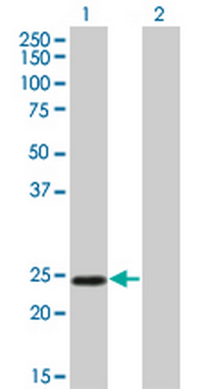 TWIST1 Antibody in Western Blot (WB)