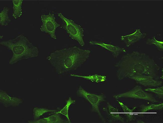 TXK Antibody in Immunocytochemistry (ICC/IF)