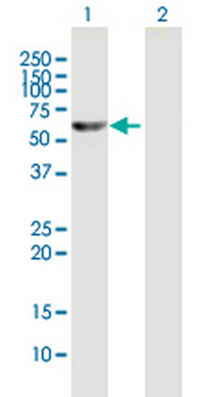 TXNRD1 Antibody in Western Blot (WB)