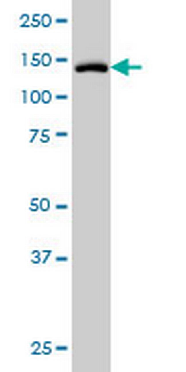 TYK2 Antibody in Western Blot (WB)