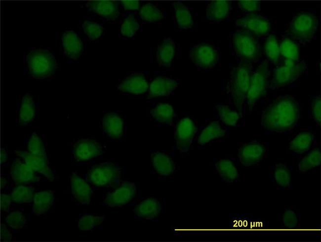 TYK2 Antibody in Immunocytochemistry (ICC/IF)