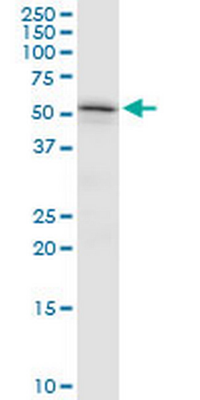 TYRP1 Antibody in Western Blot (WB)