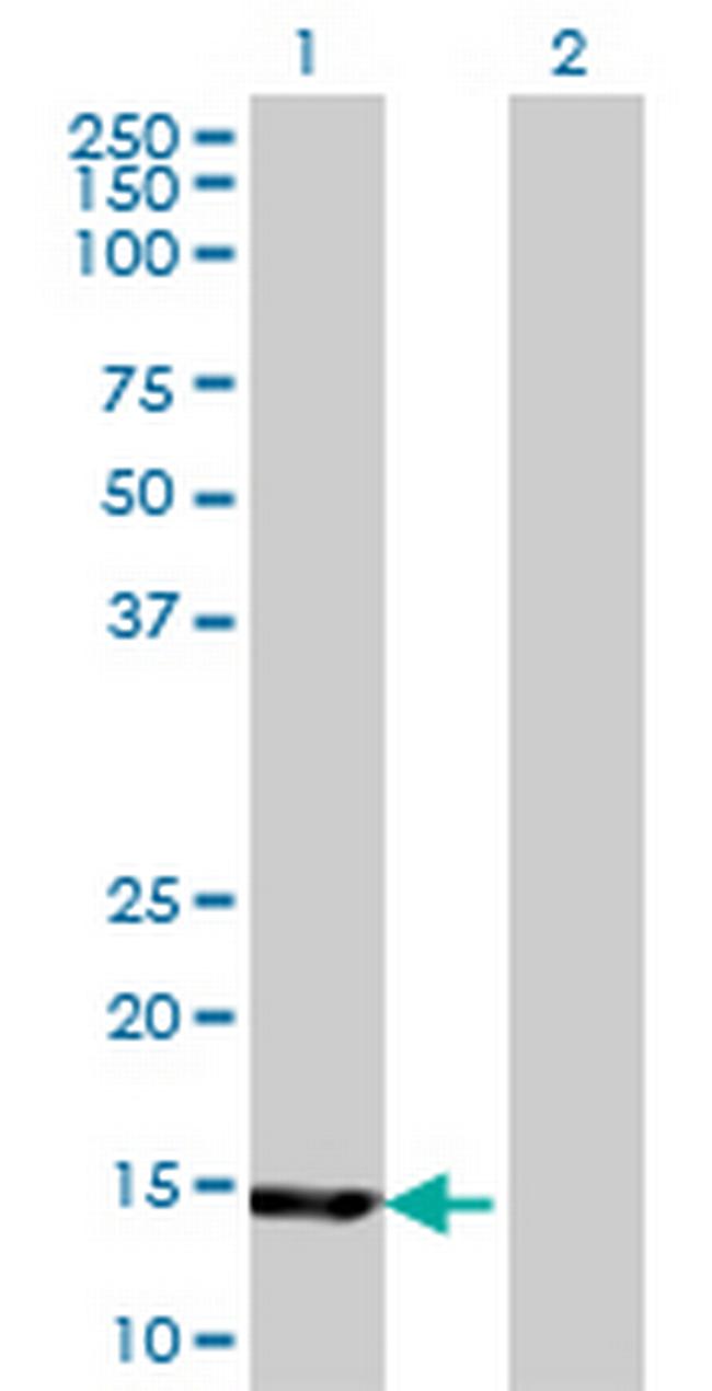 UBE2B Antibody in Western Blot (WB)