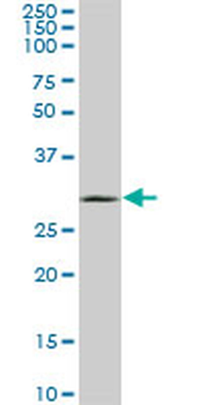 UCP1 Antibody in Western Blot (WB)