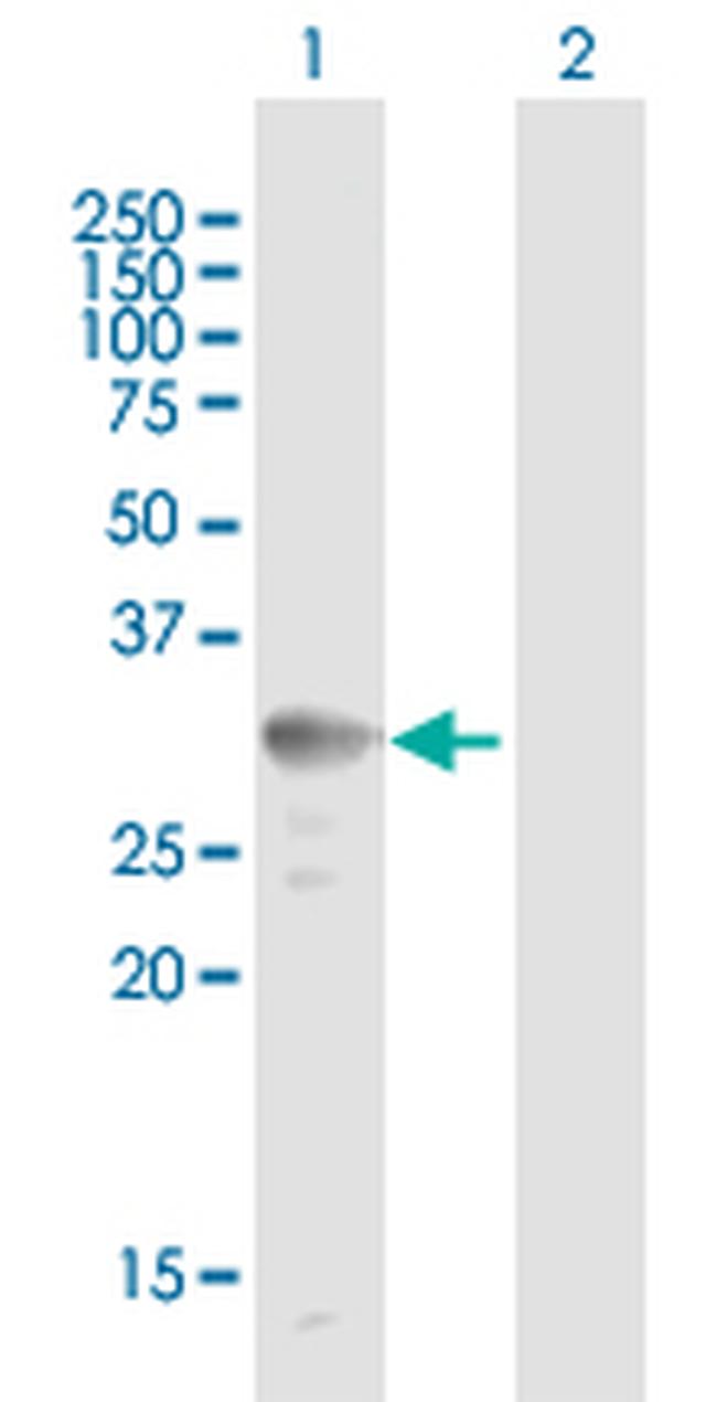 UCP2 Antibody in Western Blot (WB)