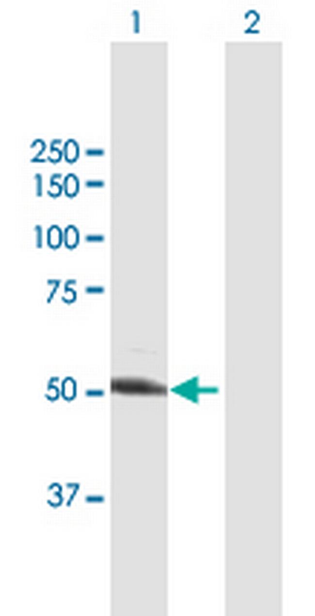 UGP2 Antibody in Western Blot (WB)