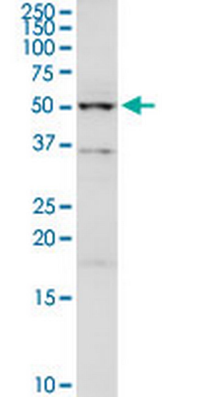 UGP2 Antibody in Western Blot (WB)