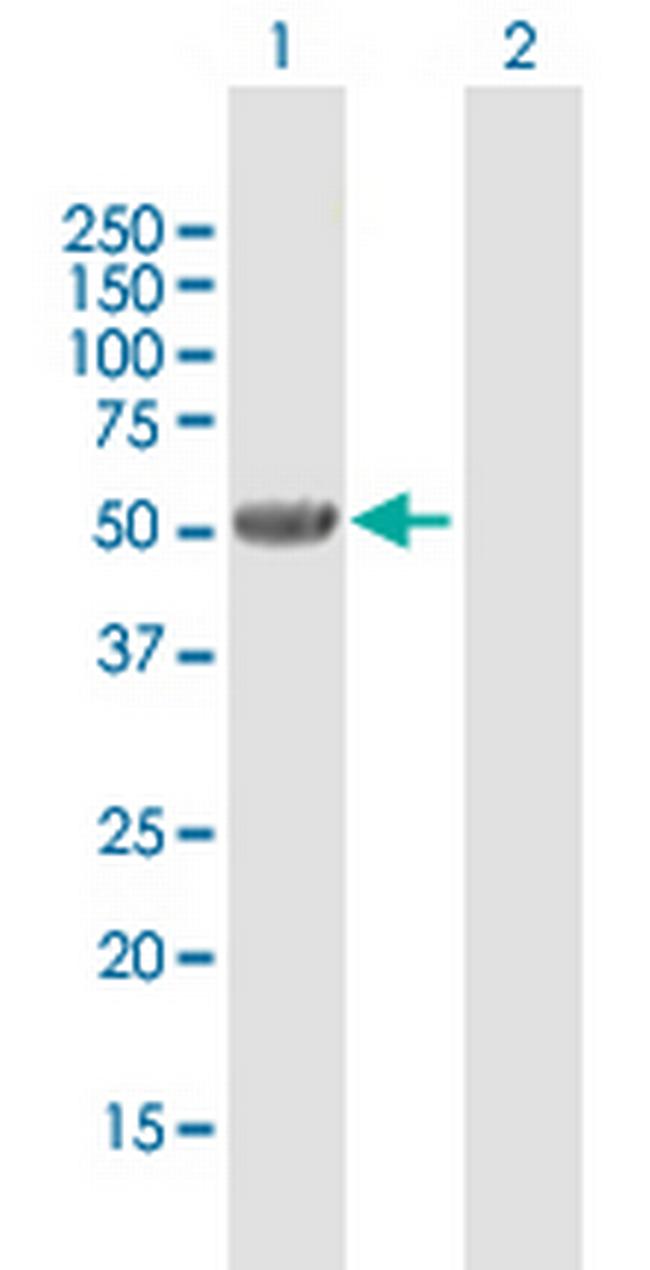 UGT2B7 Antibody in Western Blot (WB)