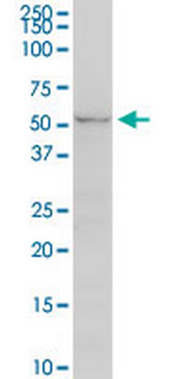 UGT2B7 Antibody in Western Blot (WB)