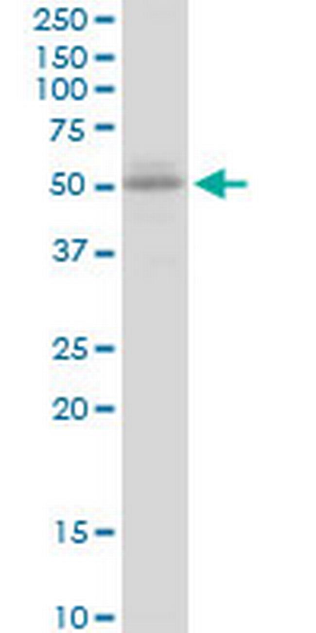 UGT2B15 Antibody in Western Blot (WB)