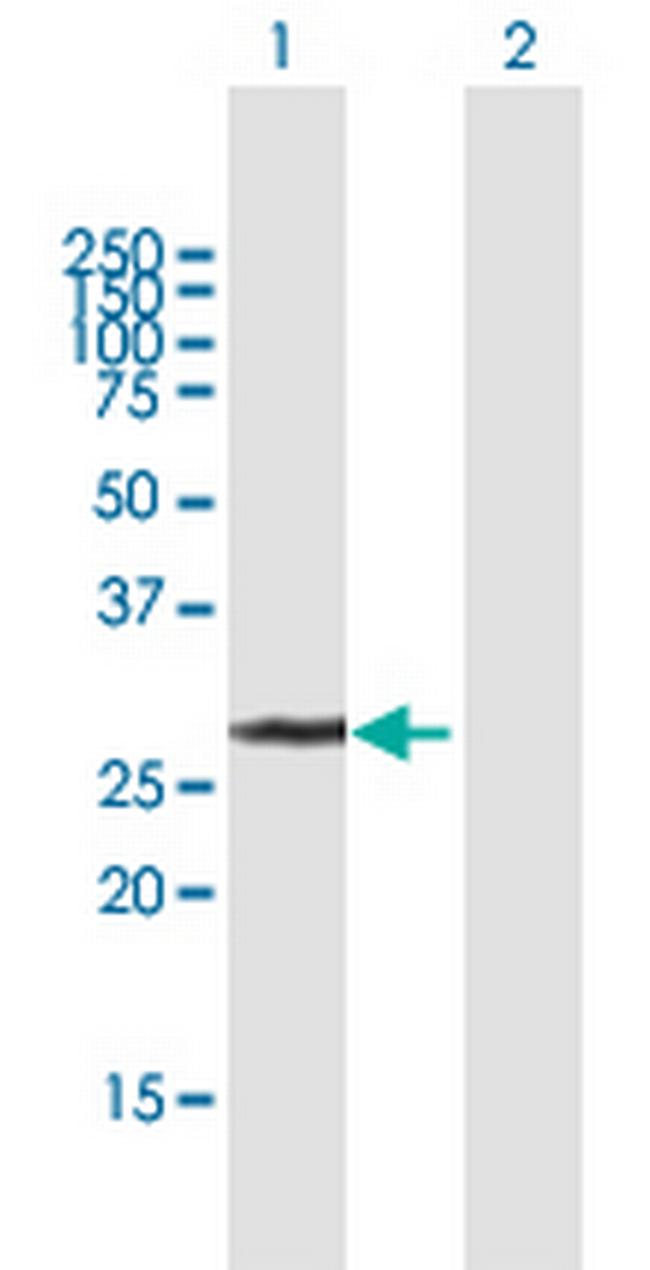 UCK2 Antibody in Western Blot (WB)