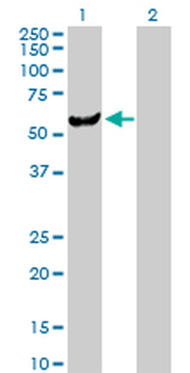 UMPS Antibody in Western Blot (WB)