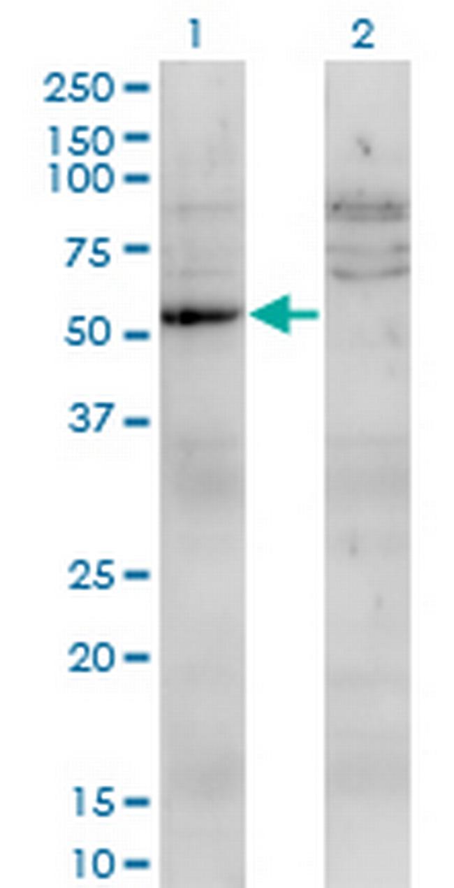 UMPS Antibody in Western Blot (WB)