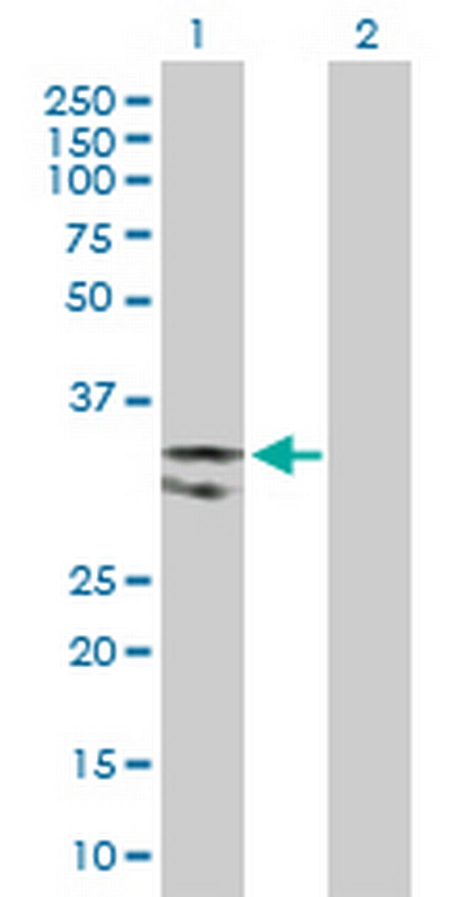 UNG Antibody in Western Blot (WB)