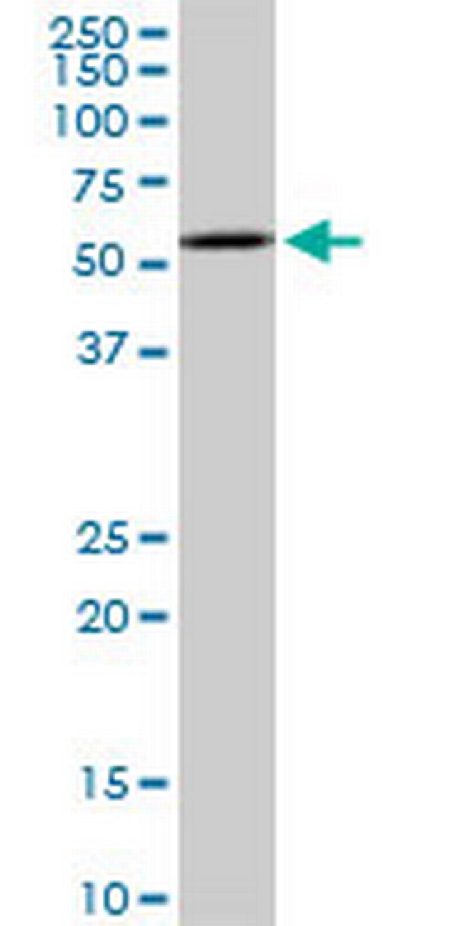 NR1H2 Antibody in Western Blot (WB)