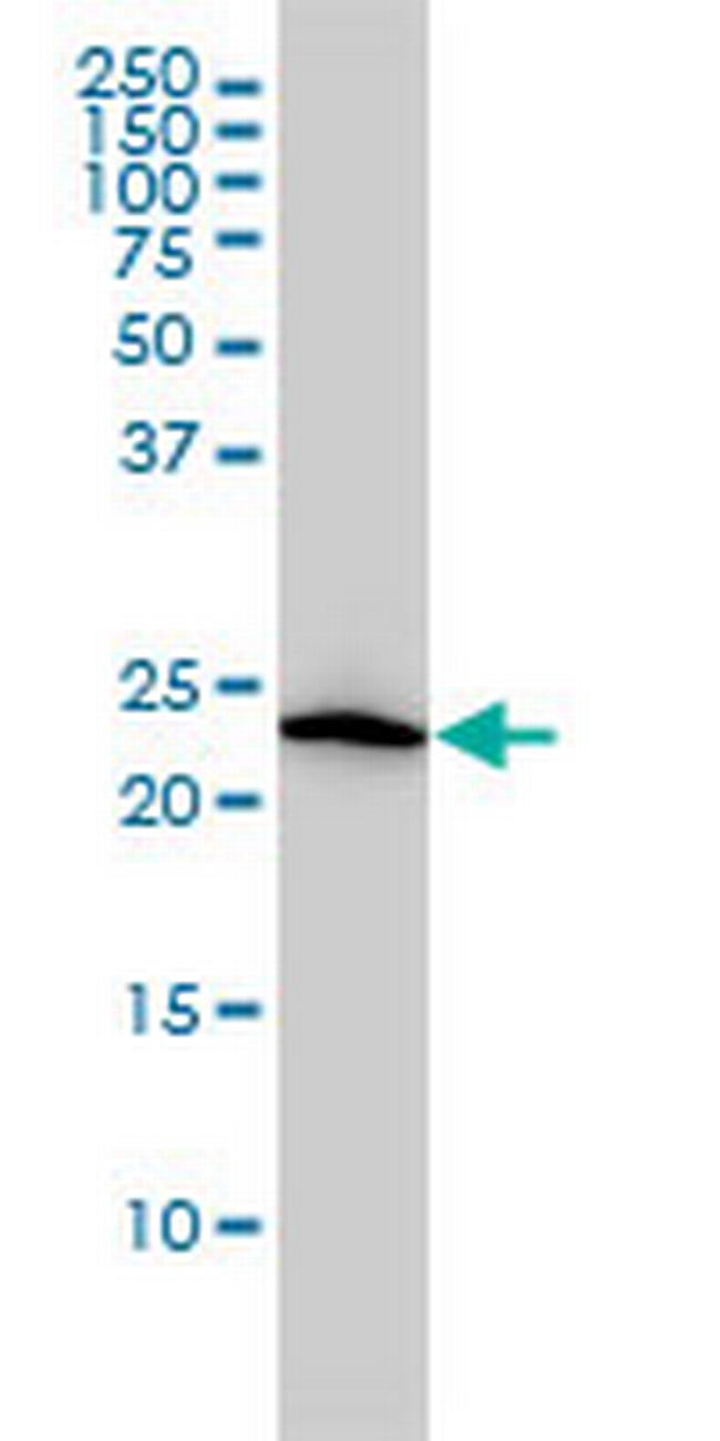 VBP1 Antibody in Western Blot (WB)