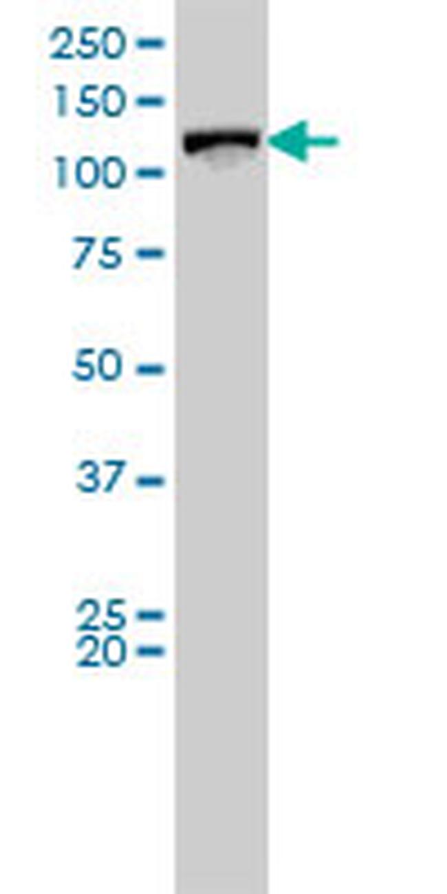 VCL Antibody in Western Blot (WB)