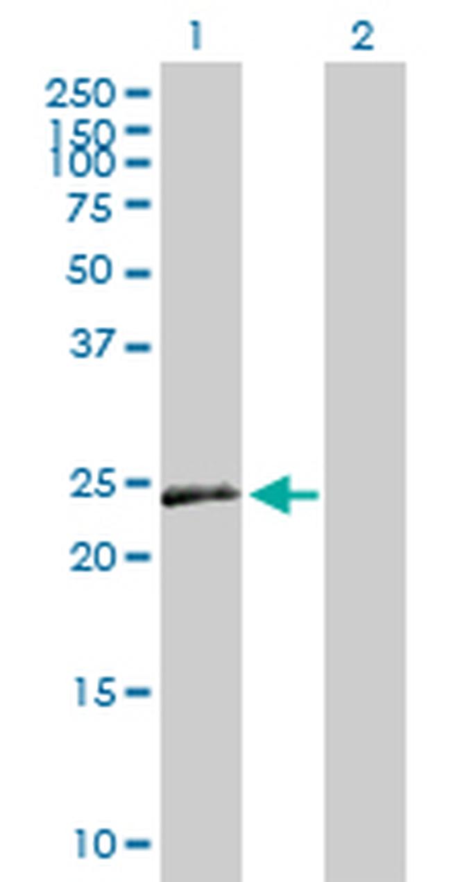 VEGFB Antibody in Western Blot (WB)