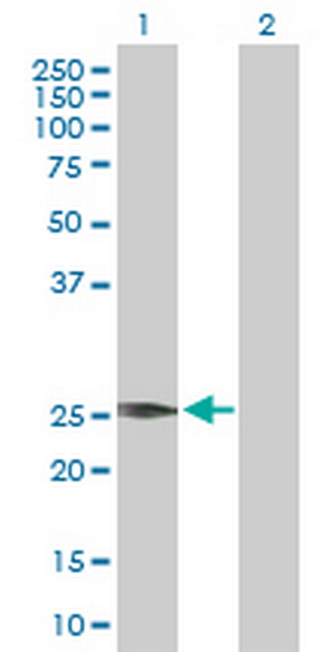 VEGFB Antibody in Western Blot (WB)