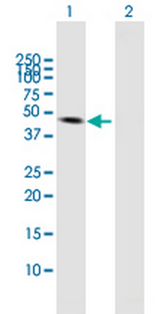 VIL1 Antibody in Western Blot (WB)