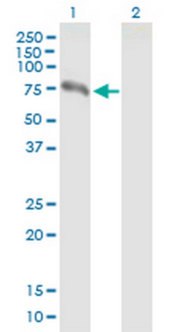 EZR Antibody in Western Blot (WB)