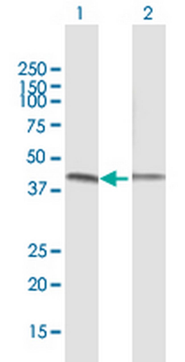 VRK1 Antibody in Western Blot (WB)