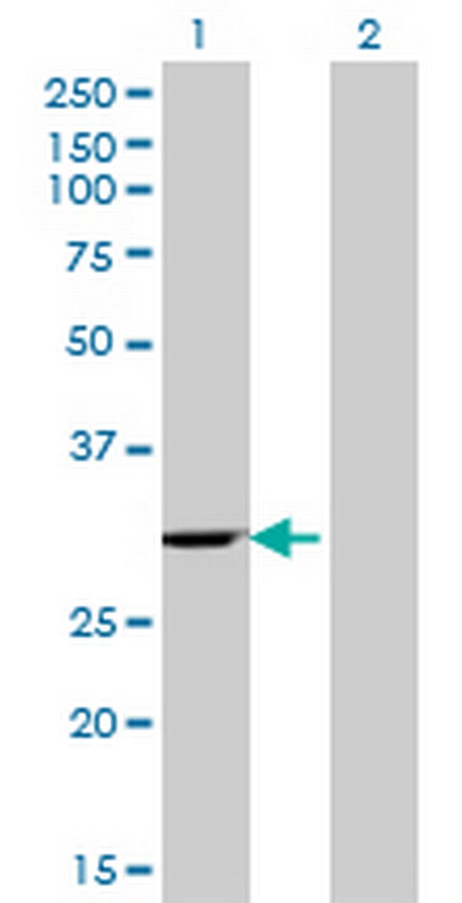 WBSCR1 Antibody in Western Blot (WB)