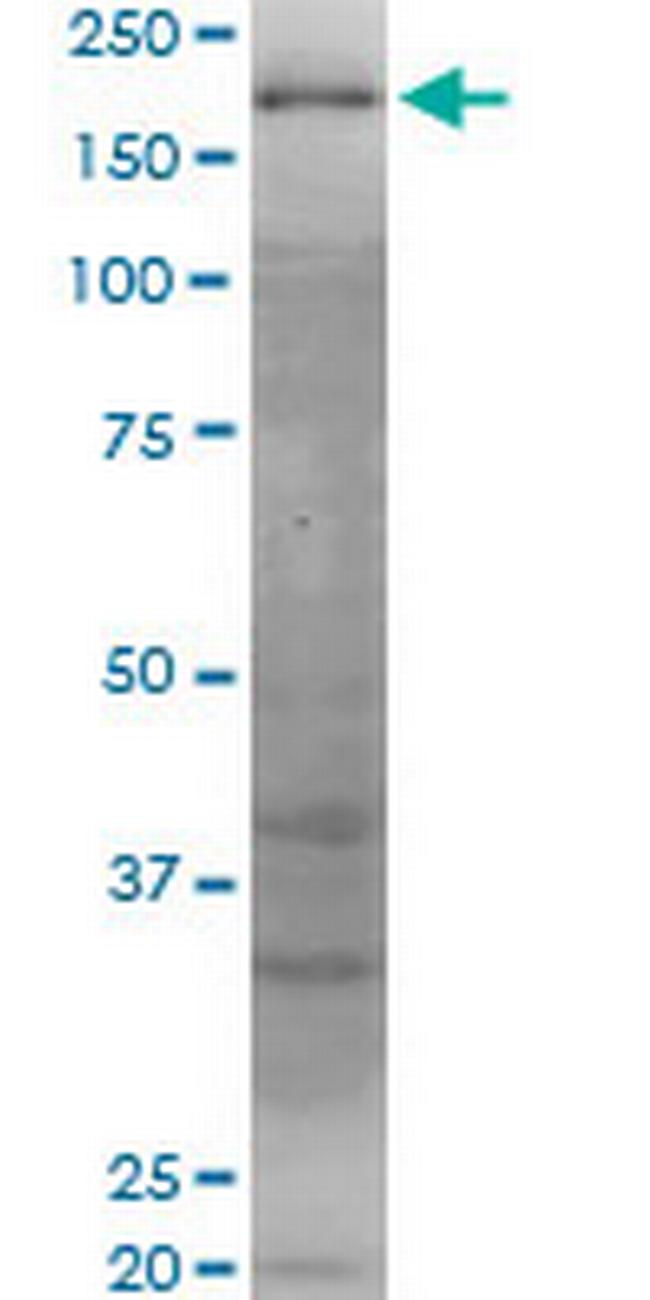 WRN Antibody in Western Blot (WB)