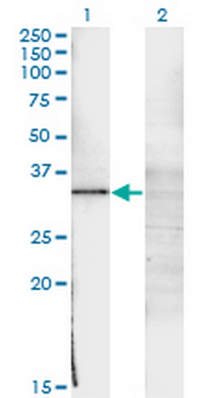 WT1 Antibody in Western Blot (WB)