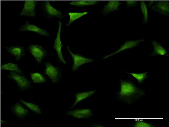 XBP1 Antibody in Immunocytochemistry (ICC/IF)