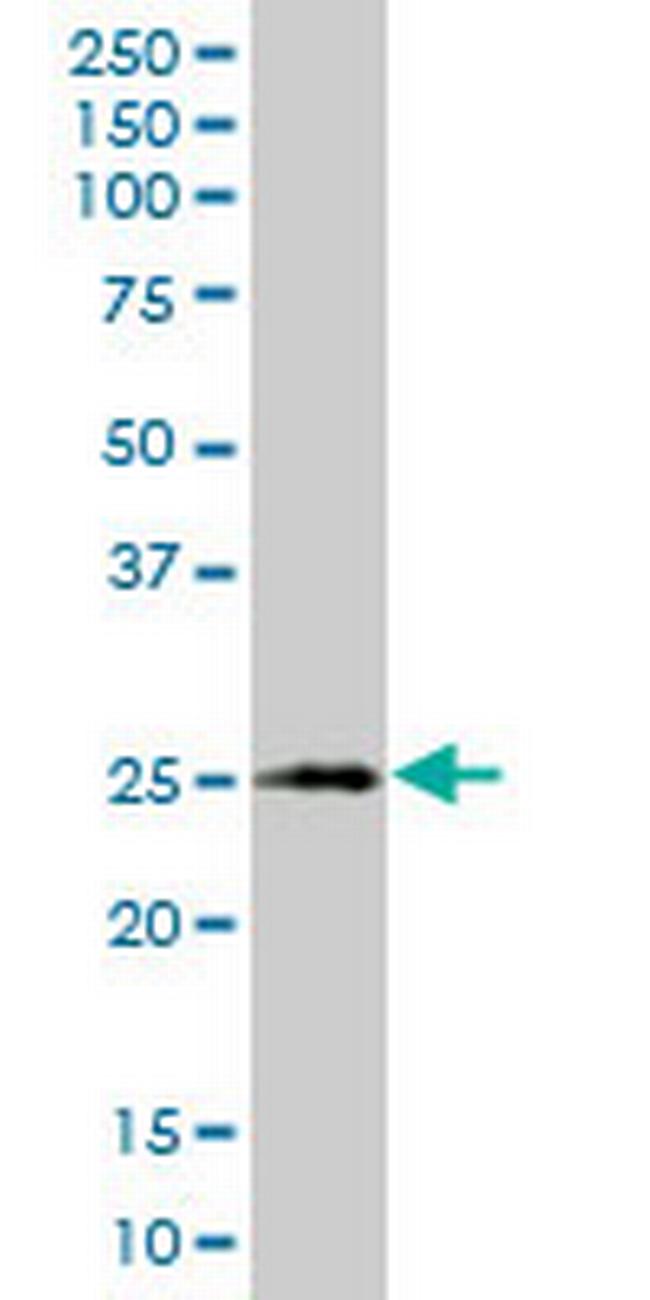 XBP1 Antibody in Western Blot (WB)