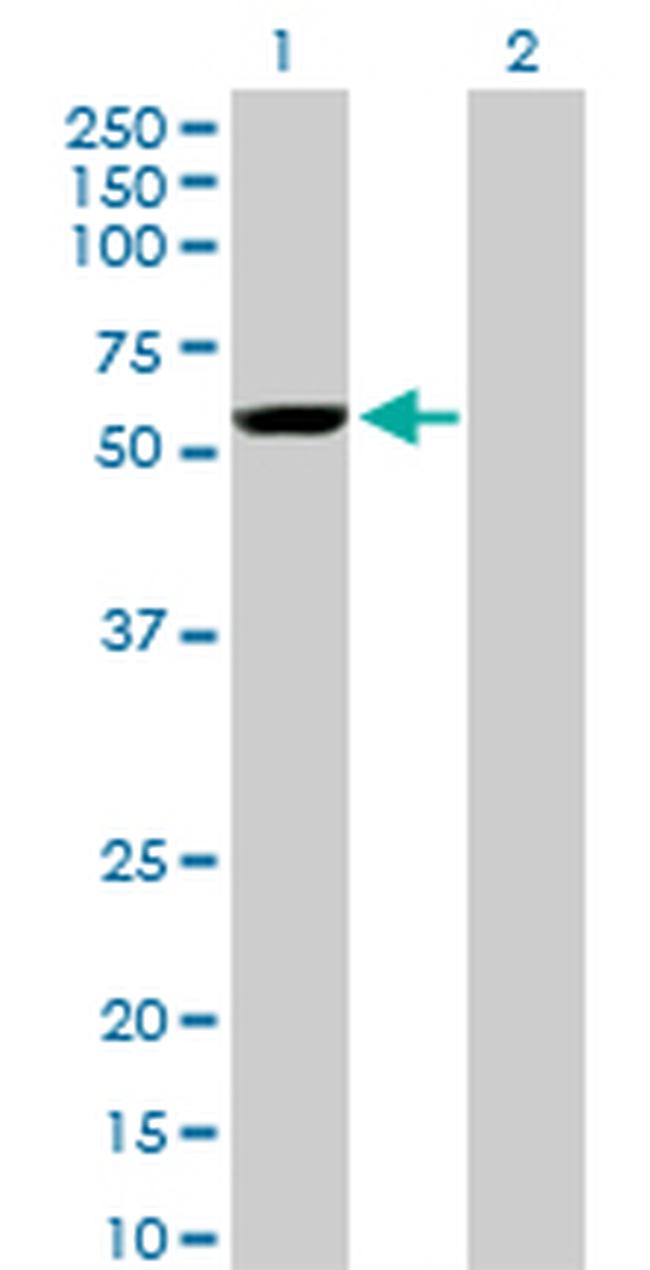 YES1 Antibody in Western Blot (WB)