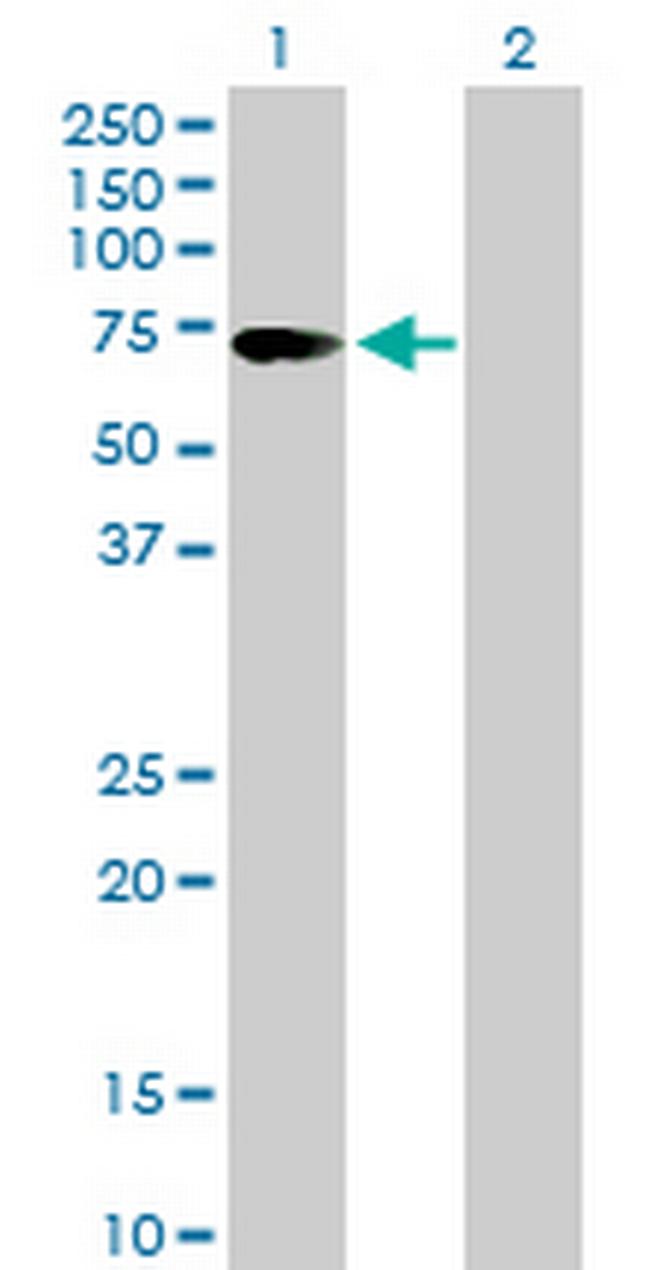 ZKSCAN1 Antibody in Western Blot (WB)