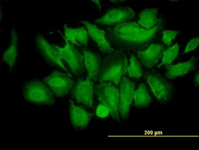 TRIM25 Antibody in Immunocytochemistry (ICC/IF)