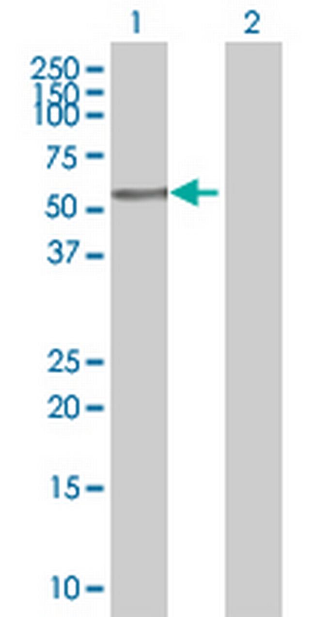 ZNF223 Antibody in Western Blot (WB)