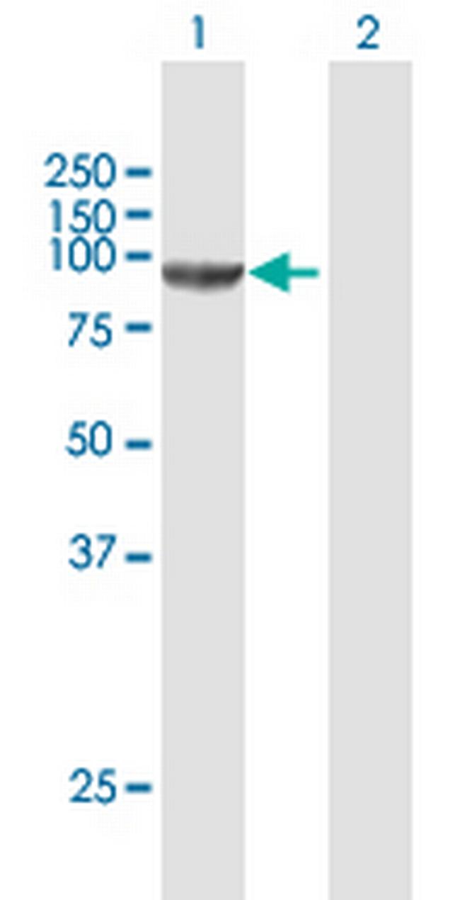 CSDE1 Antibody in Western Blot (WB)