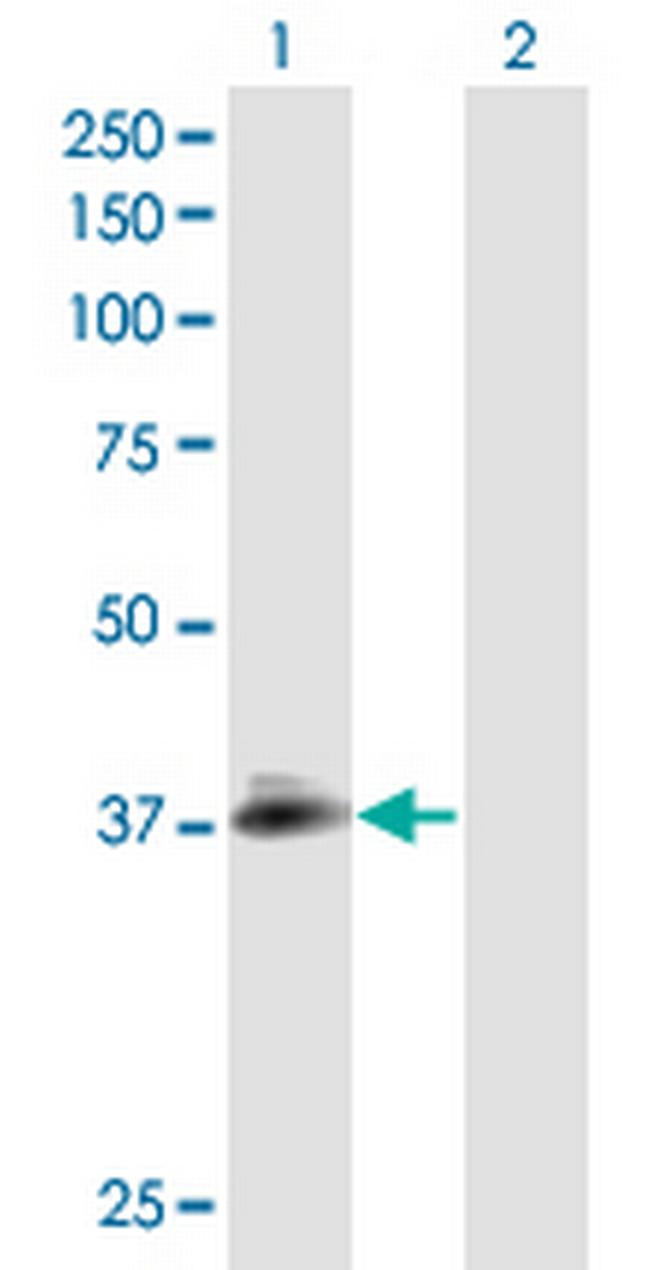 NPHS2 Antibody in Western Blot (WB)