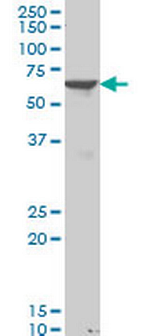 PAX8 Antibody in Western Blot (WB)