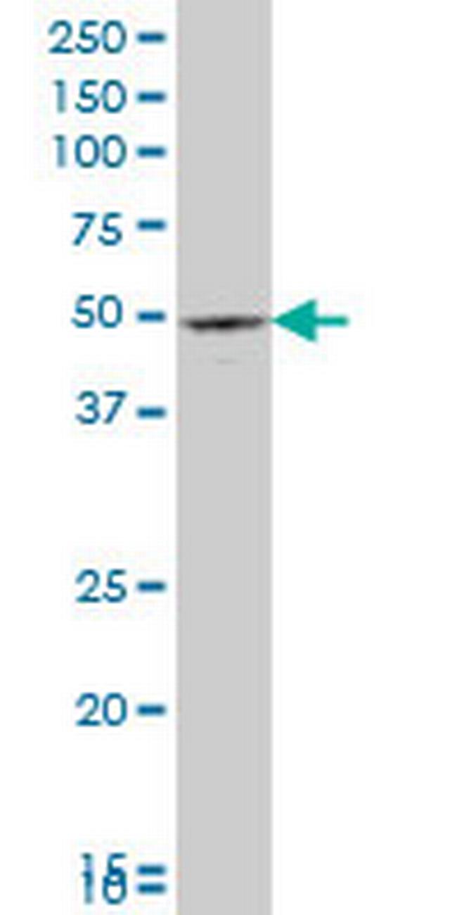 PAX8 Antibody in Western Blot (WB)