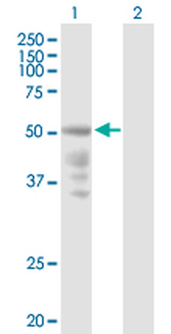 CXCR4 Antibody in Western Blot (WB)