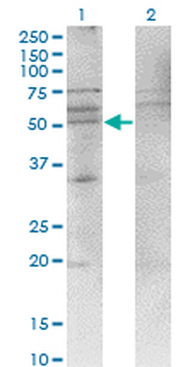 CXCR4 Antibody in Western Blot (WB)