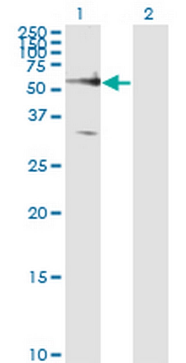 FZD5 Antibody in Western Blot (WB)