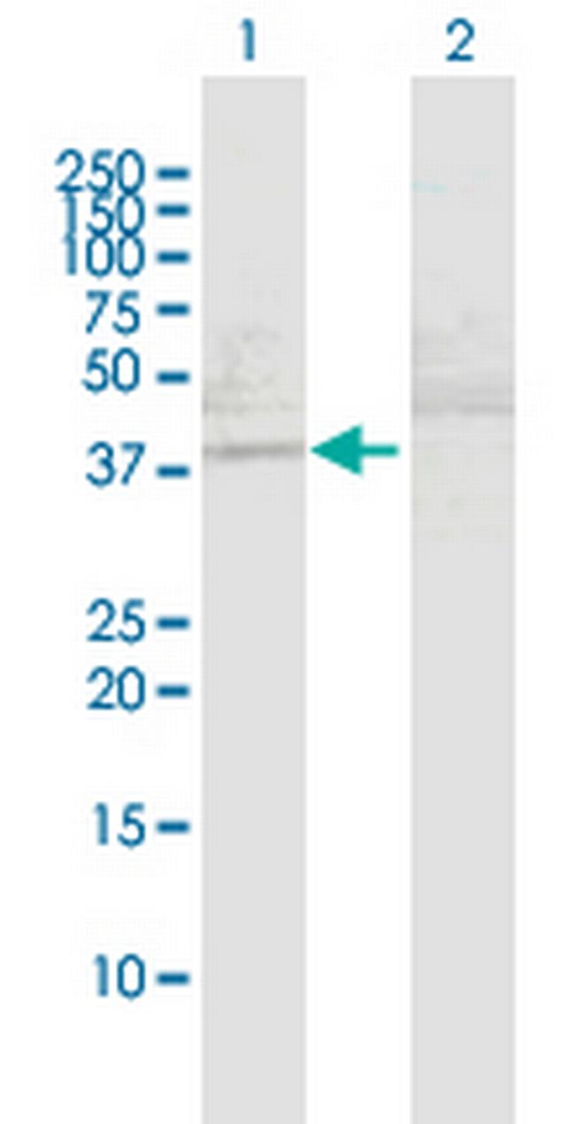 MAPKAPK3 Antibody in Western Blot (WB)