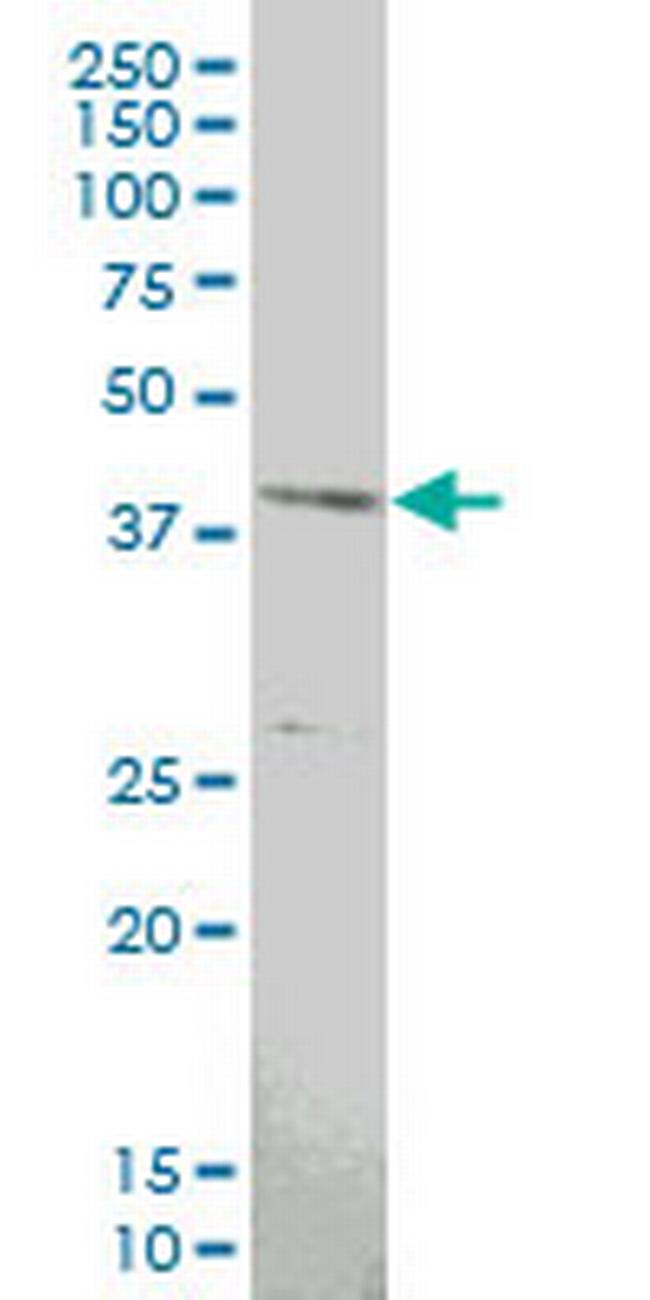 MAPKAPK3 Antibody in Western Blot (WB)