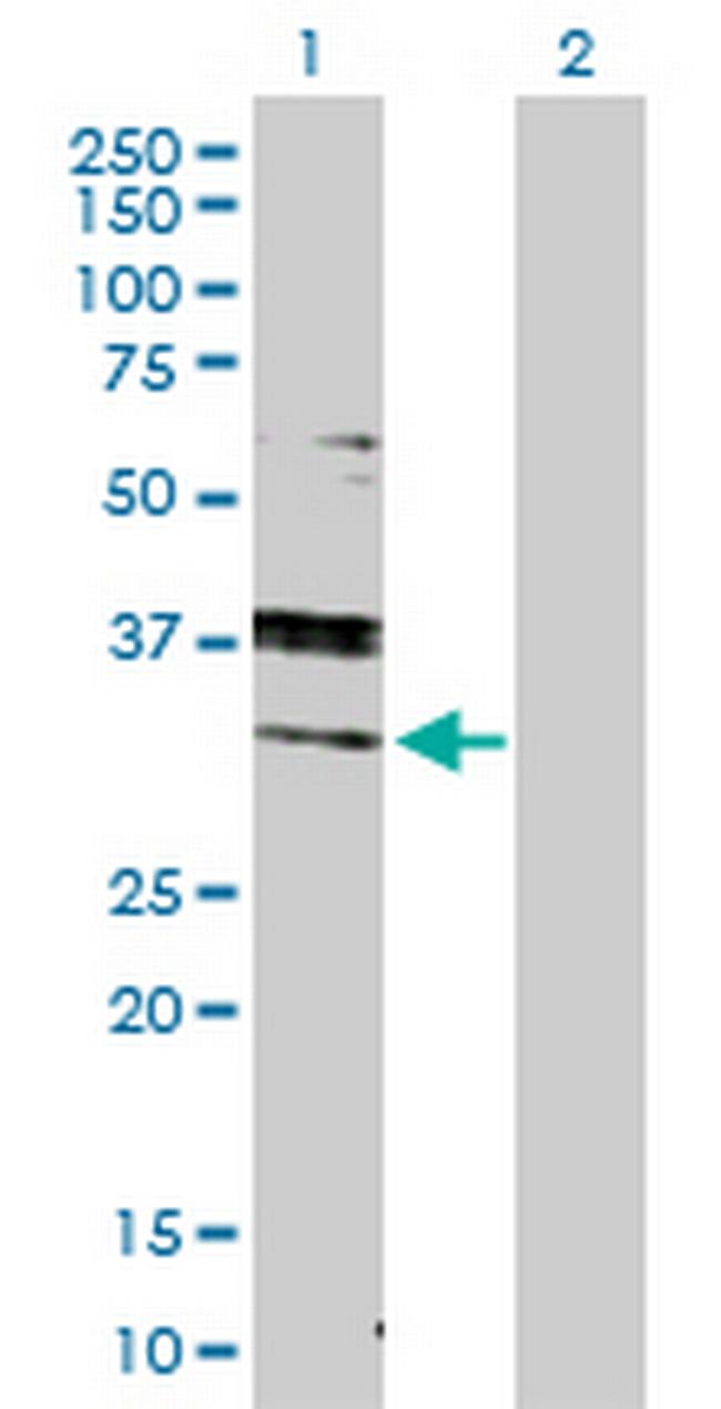 RAB7A Antibody in Western Blot (WB)