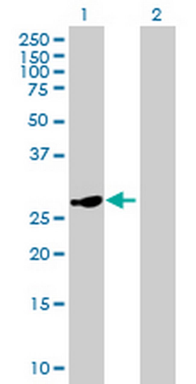 HSD17B8 Antibody in Western Blot (WB)