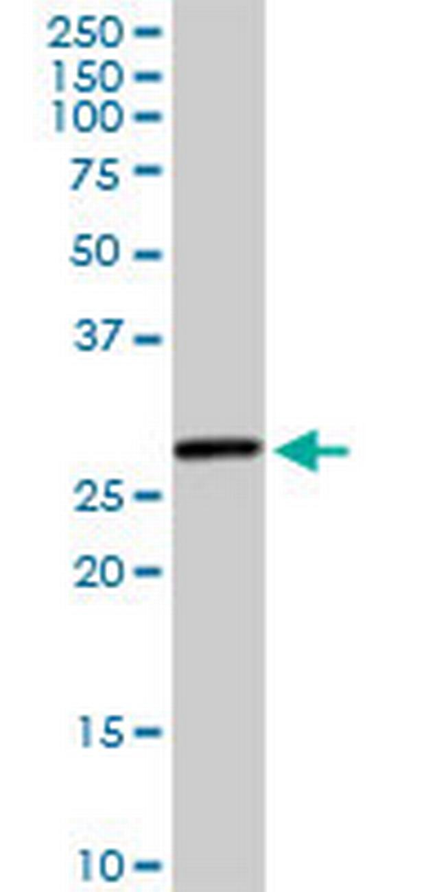 HSD17B8 Antibody in Western Blot (WB)