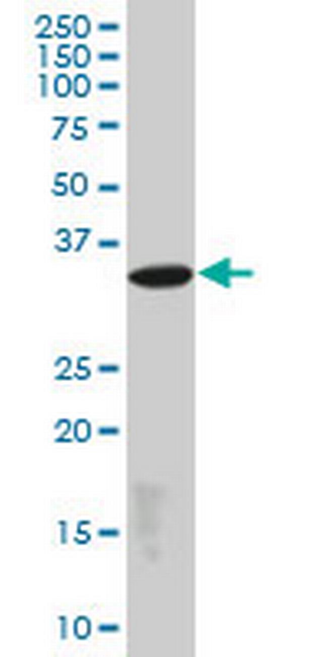 EPM2A Antibody in Western Blot (WB)