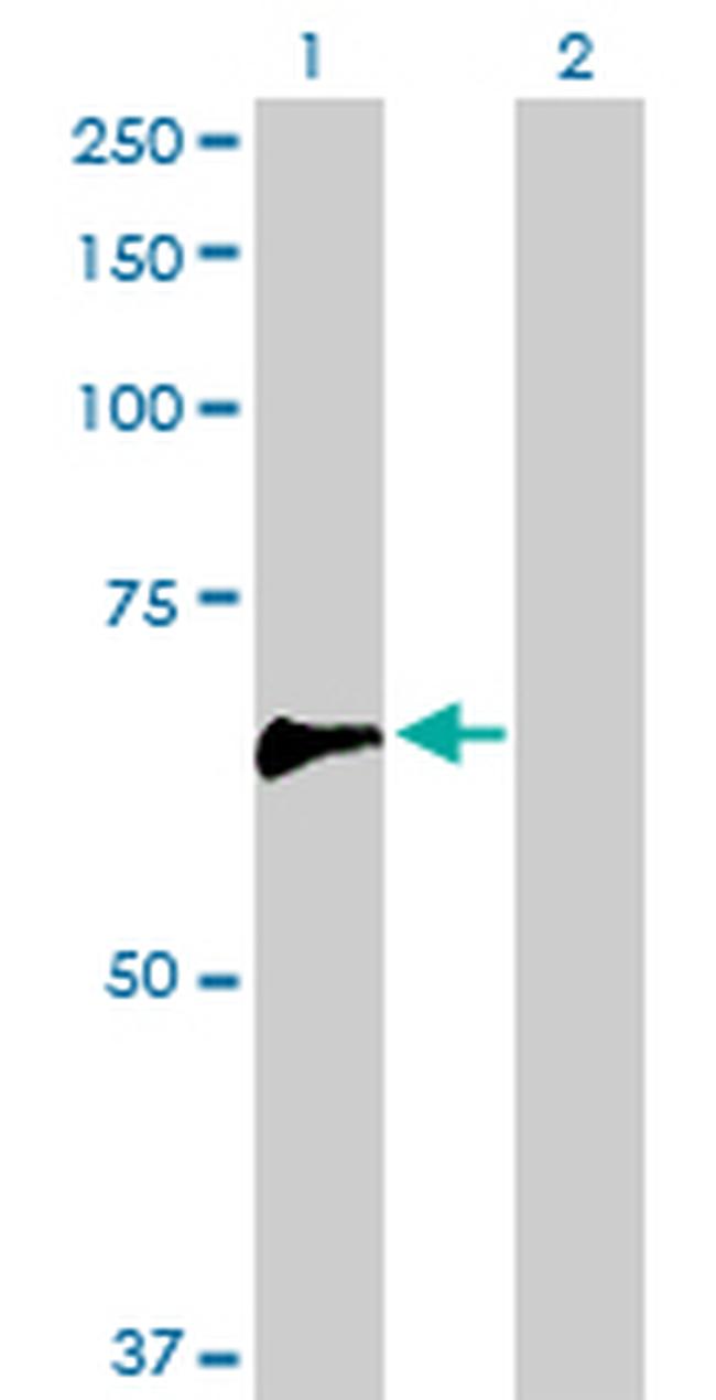 ARHGEF5 Antibody in Western Blot (WB)