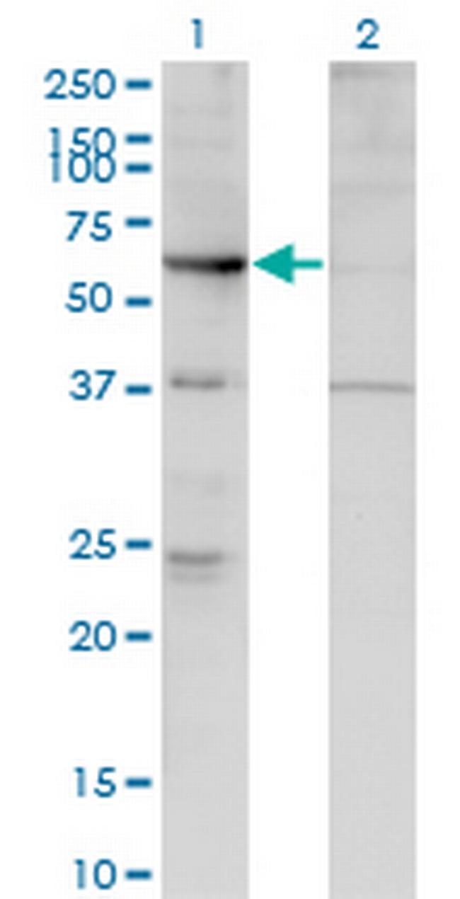 ARHGEF5 Antibody in Western Blot (WB)